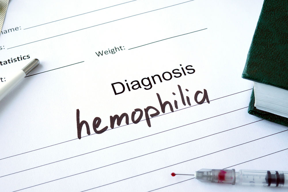 Symptoms and Treatment of Hemophilia