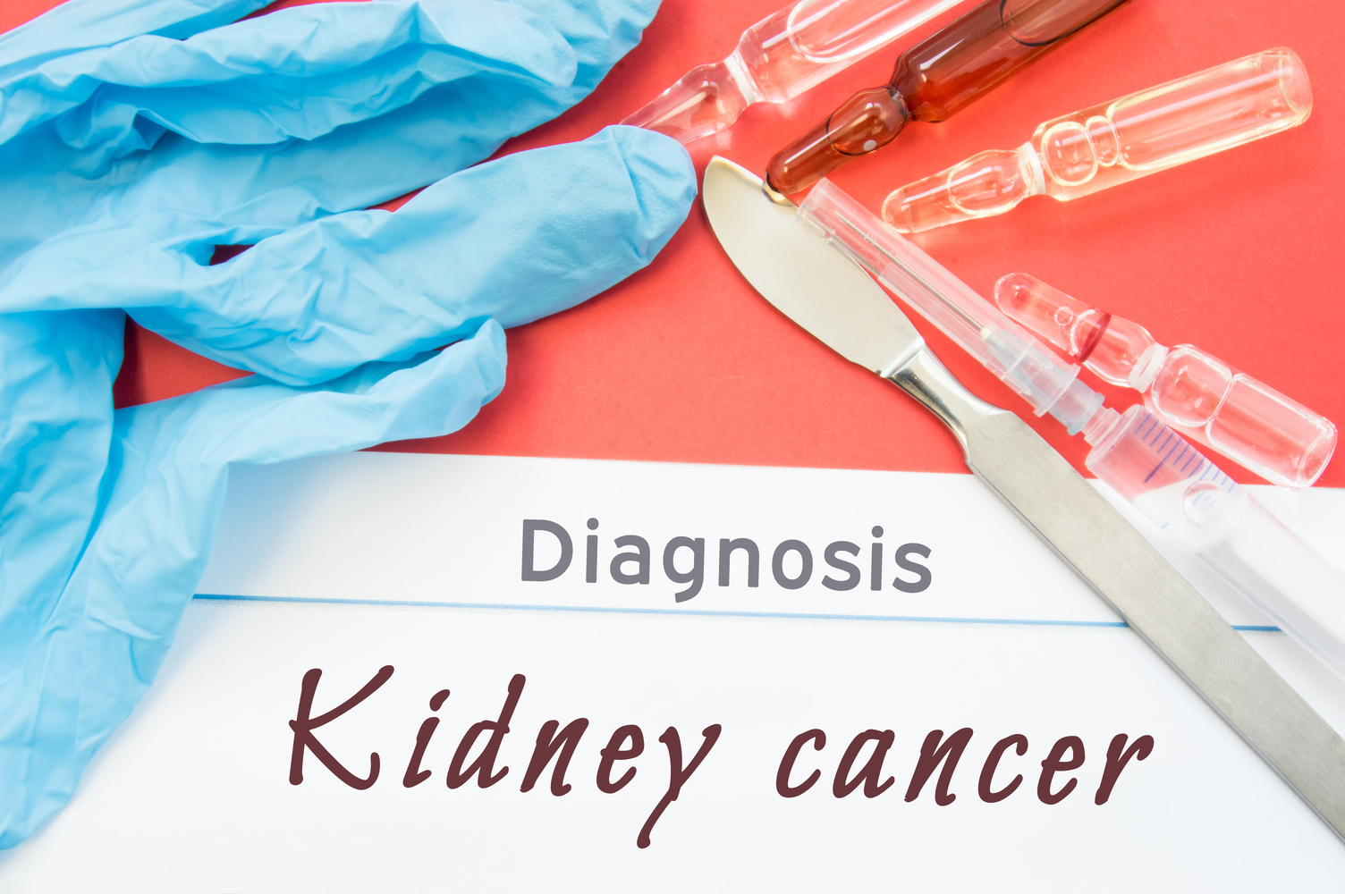 The Stages and Treatment for Kidney Cancer