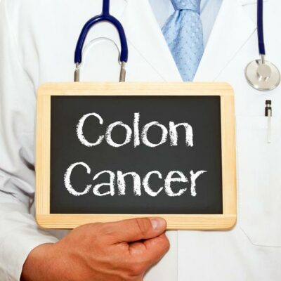 5 Early Signs of Colon Cancer